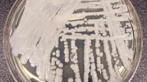 Why scientists are nervous about fungi