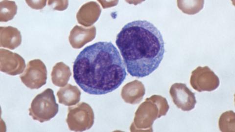 Why scientists are rethinking the immune effects of SARS-CoV-2