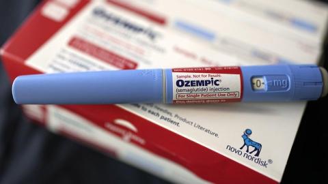 Why some people lose their hair when they’re on GLP-1s