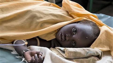 Worsening cholera epidemic in Africa will hit kids hardest