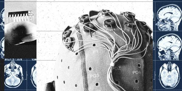 China Is Building a Brain-Computer Interface Industry