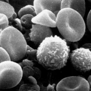 Plan for a world of post-COVID immune effects